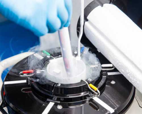 国内生殖代孕机构,正常精子形态＞4％正常，流产与精子质量不好也有关
